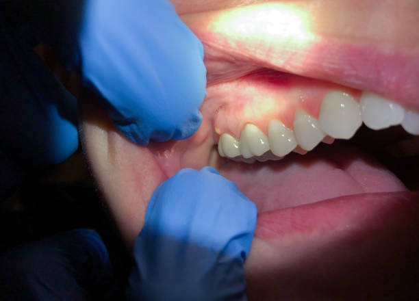 Best Emergency Dental Care for Trauma or Injury in Slippery Rock University, PA