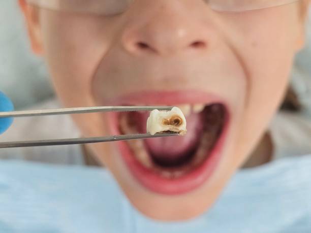 Best Walk-In Emergency Dentist in Slippery Rock University, PA